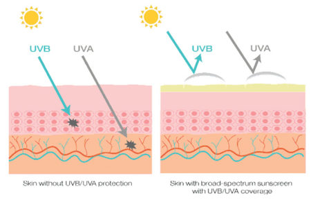 chart showing sunscreen protection from UVB and UVA rays